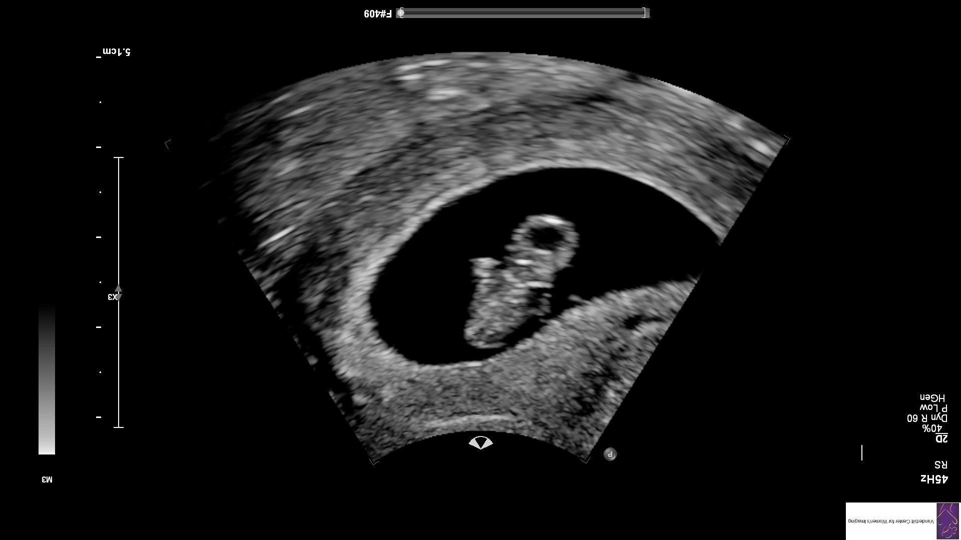 Baby McCravy coming August 2021. Telling the pregnancy story on the Breakthrough Brand Podcast